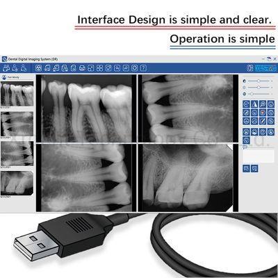 Best Price Intraoral Imaging X Ray Sensor Digital Dental X Ray Sensor