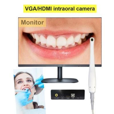 Portable TV Oral Camera with 10 Bright &amp; Clear LEDs HD Image VGA/AV Output