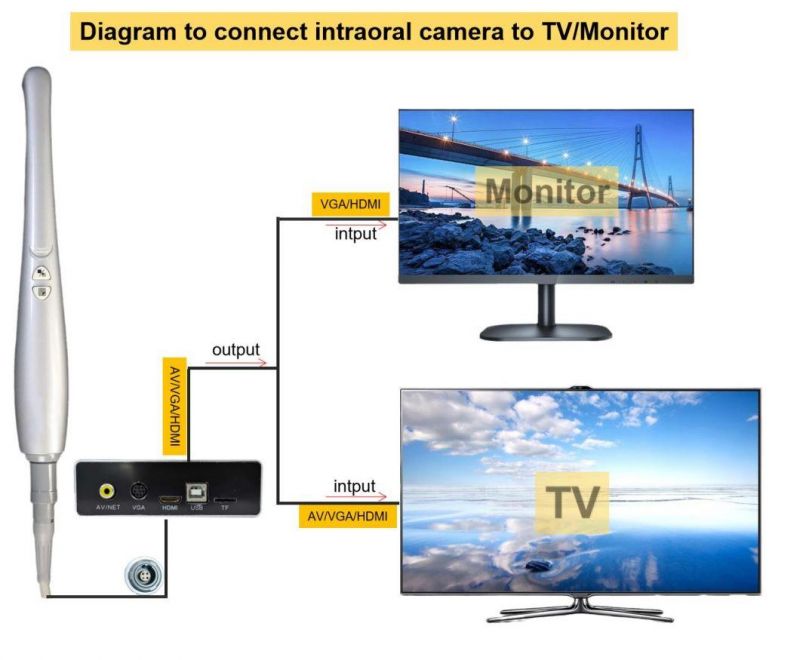 1080P TV Oral Camera Super Clear Image Vivid Show on Big Screen