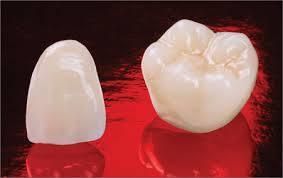 Dental Full Zirconia Crown From China Dental Lab