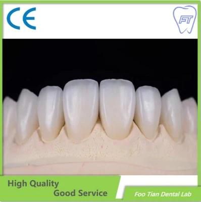 Customized Zirconia Crown and Bridge Made From China Dental Lab