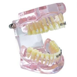 Dental Education Use Standard Typodont Dental Model Teeth Typodont Nissin Adult/Children 28/32PCS