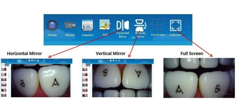 Lenses Can Be Cleaned with Wet Wipes Oral Camera