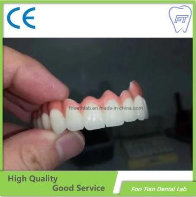 Orthodontics Treatment Dental Metal Ceramic Crown Made in Foo Tian Dental Lab in Shenzhen China