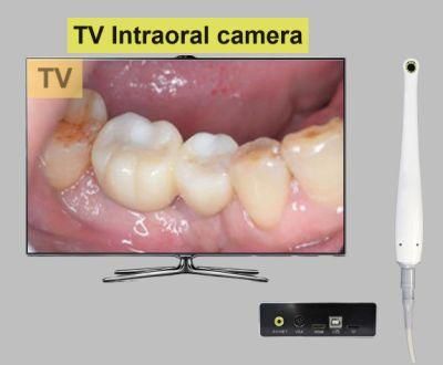 High Pixel VGA/AV Medical Video Recording Intraoral Camera 1/4 Screen Suitable for All Dental Clinics