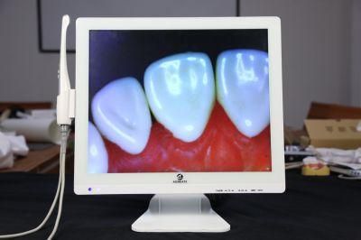 Oral Camera Suitable for Oral Clinic