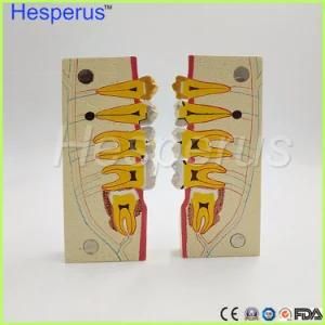 Dental Teeth Model Lower Right Posterior Teeth Tissue Decomposition Model Doctor with Magnetic
