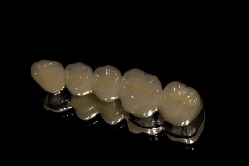 Dental Material Lab Implant Dental Lab Supplies Full Contour Zirconia Bridge with Natural Shade and Shape