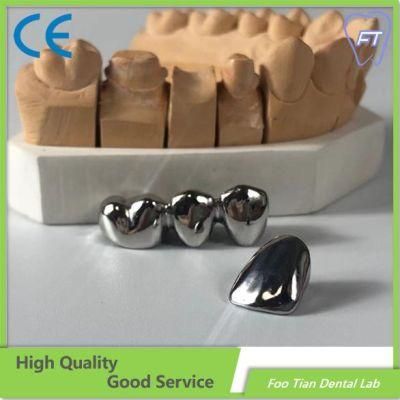 High Quality Dental Metal Ceramic Crown Dental Implant Customized