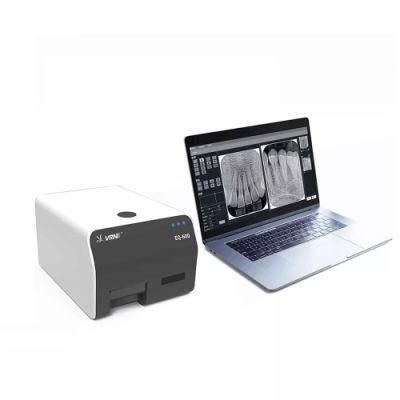 Dental Digitalized Intraoral Imaging Plate X Ray Film Scanner