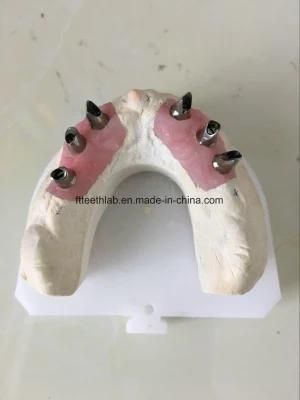 Dental Material Implant Supplies Dental Custom Titanium Abutments Used for Implant Cases