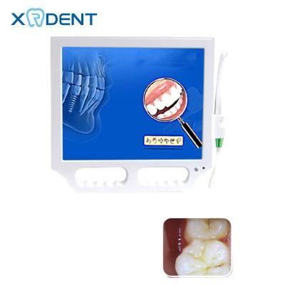 Dental Intra Oral Camera Dental Intraoral Camera Wireless Intraoral Camera Dentist Clinic 17 Inch