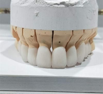 Dental Lab Pfm Crown and Bridge From China Dental Lab