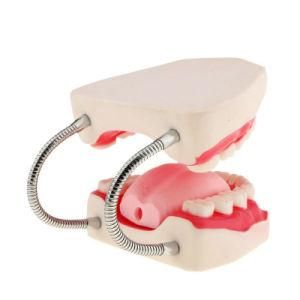 Demonstration Model (Teaching Resources Dentist Used) of Tooth Decay and Caries Development Decayed Teeth Anatomical Model