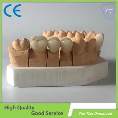 Denture Bridge and Zirconium Crown Custom Dental Material Lab Implant Full Contour