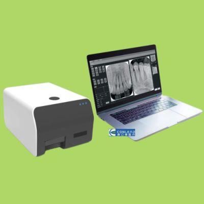 Dental Image Plate Scanner X Ray Reader Dental Intraoral Cr Imaging Plate Scanner X Ray Film Scanner