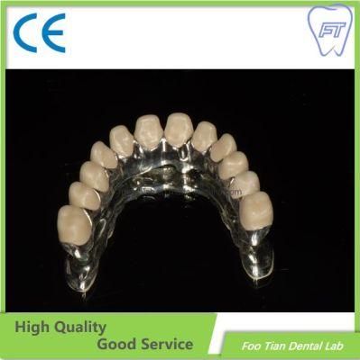 Zirconium Crown Custom Dental Material Lab Implant Dental Lab Full Contour Without Porcelain