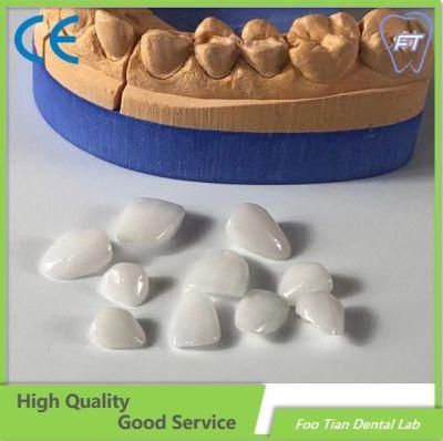 Emax Veneer Dental Inlays and Crowns with High Aesthetic Customized