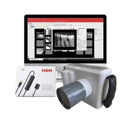 Dental Portable X Ray Machine Can Use with Hdr500 Sensor Set