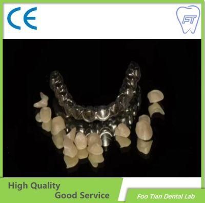 Orthodontics Treatment Zirconia Crown Made From China with High Aesthetic and Natural Customized