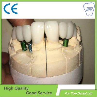 Implant OEM Bruxzir Solid Stable Zirconia Bridge From China Dental Lab
