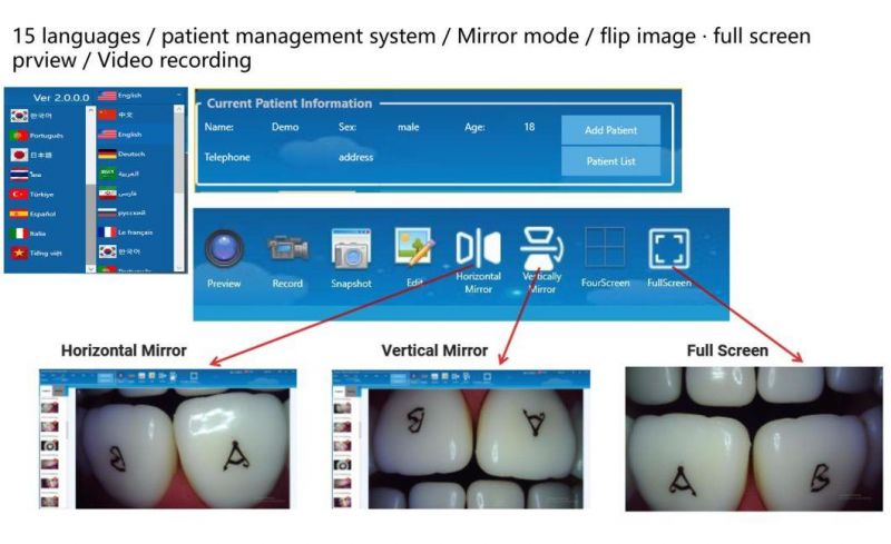 Lightweight and Portable to Prevent Shaking Medical Oral Camera