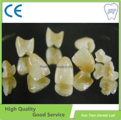 Emax Orthodontic Products Dental Material Supplies Implant Emax Ceramic Inlay/Onlay From China Dental Lab