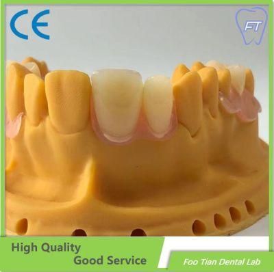 Professional Services Orthodontics Study Model Removable Denture