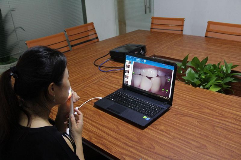 Portable High Pixel USB Dental Intraoral Camera 720p Video Shooting