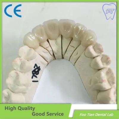 Selling Zirconium Crown Custom Dental Material Lab Implant Dental Lab Full Contour Without Porcelain