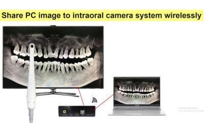 Wired TV Dental Camera 2 Meters Cable 10 LEDs 18 Months Warranty Plug and Play From Factory