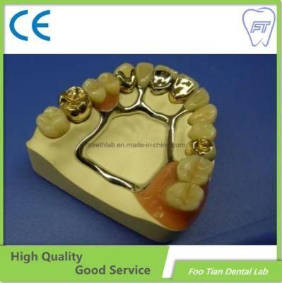 Dental Lab Services Removable Metal Denture Cast Partial Framework Dental