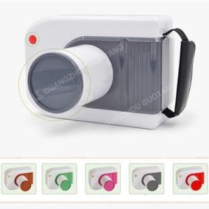 Mobile Camera Type Mini Portable Dental Digital X-ray Machine