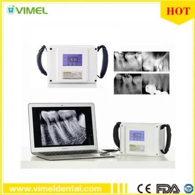 Dental Portable X Ray Unit Machine Hospital Medical Equipment