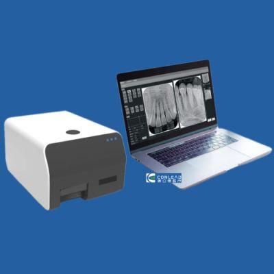 Dental X-ray Intraoral Digital Imaging Phosphor Plate Scanner / Digitalized Intraoral Image Plate Scanning &amp; Processing System