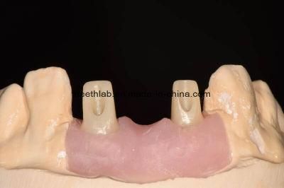 Full Ceramic Customized Dental Implant Abutment