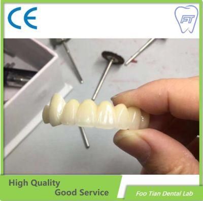 Selling Bruxzir Solid Stable Zirconia Bridge From China Dental Lab