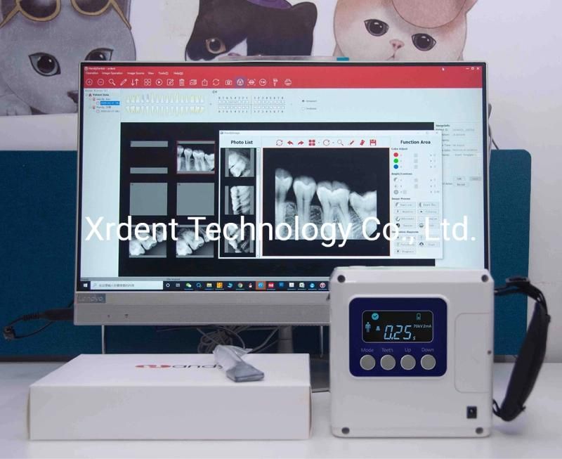 Most Safety Low Radiation 70kv Portable Dental X-ray Unit