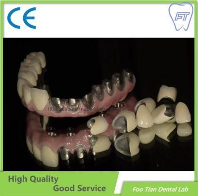 Hybrid Implant Denture Supplies Dental Custom Titanium Abutments Used for Implant Cases