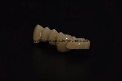 All Ceramic Fixed Dental Restoration Made in China Dental Lab
