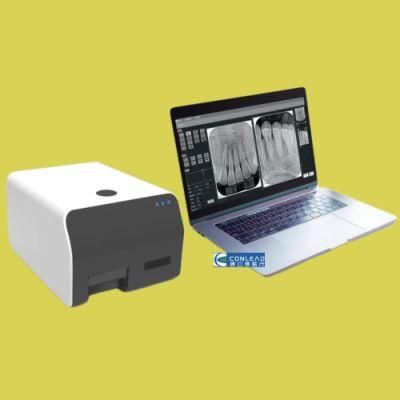 Digital Radiography X-ray PNG Image Scanner, Processes All Usual Intraoral Sizes From Size 0 to Size 3 Quickly and with Superb Resolution