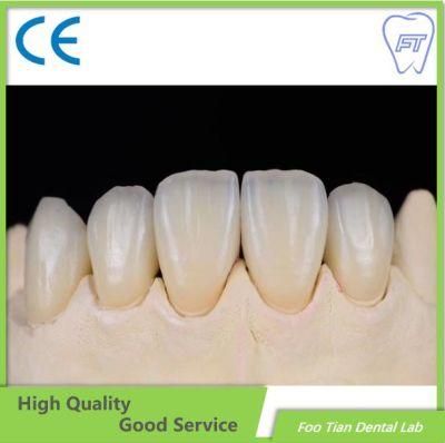 Dental Lab Services Zirconium Crown Custom Dental Material Lab Implant Full Contour Without Porcelain