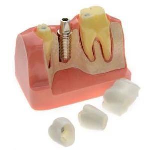 Dental Equipment Tooth Model Early Childhood Education Brushing