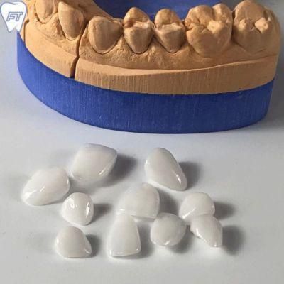 Dental Material Lab Implant Dental Lab Custom Affordable Ultra Thin Veneers Without Any Preparation