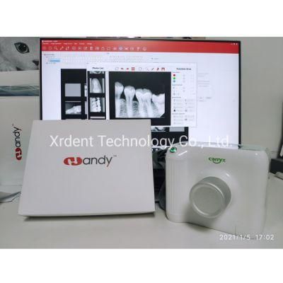 Adopt Korean Circuit Board Digital Portable Dental X Ray Camera Manufacturer
