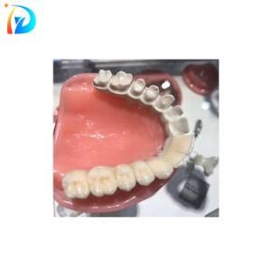 Lower Density Dental Peek Disc for Healing Screw Dental Lab