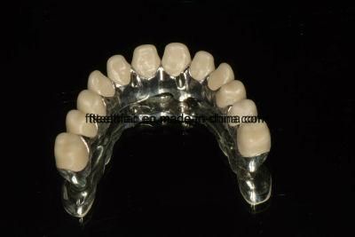Dental Full Ceramic Zirconium Implant Bridge