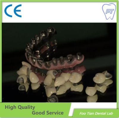 Good Product Zirconia Crown and Bridge Made From China Dental Lab
