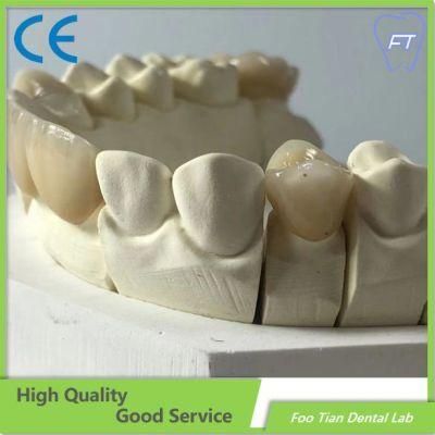 Factory Manufacture Dental Implant Emax Dental Inlays and Crowns with High Aesthetic