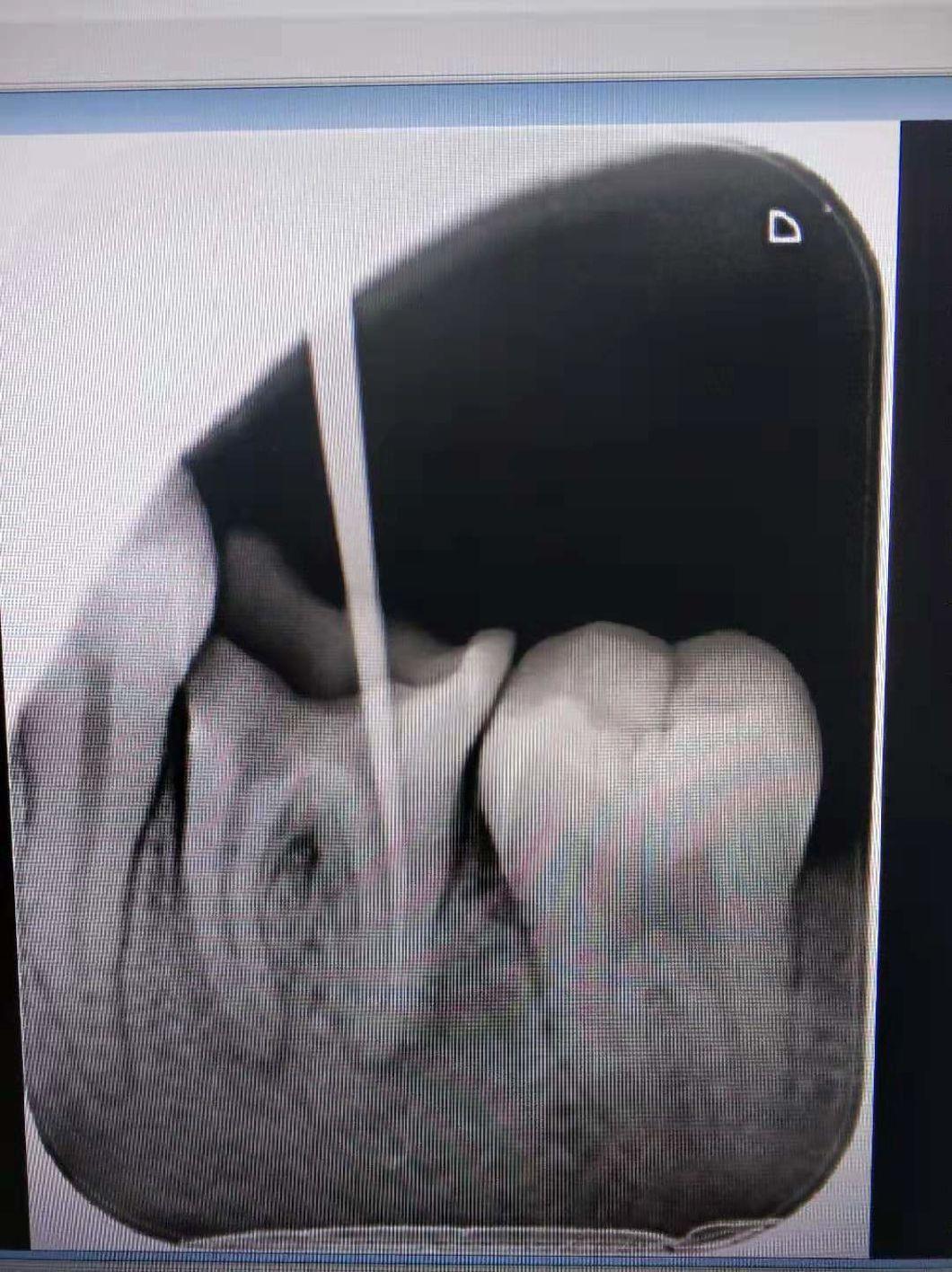 High Frequency Low Cost Professional Oral X-ray Machine